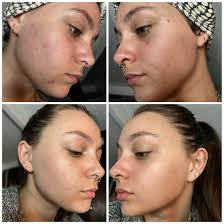 کنسانتره شب رتینول خالص و قوی 1% نامبر سون No7 Pure Retinol 1% Retinol Night Concentrate
