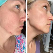 کنسانتره شب رتینول خالص و قوی 1% نامبر سون No7 Pure Retinol 1% Retinol Night Concentrate