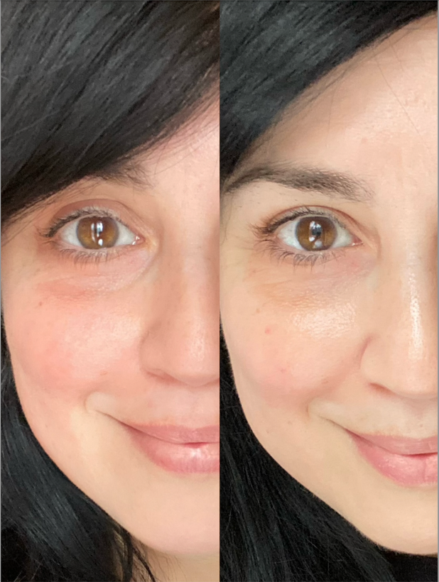 دور چشم 96 ساعته هیدروفیلر کلینیک MOISTURE SURGE EYE 96-H – آبرسان ۹۶ ساعته و ضد خستگی