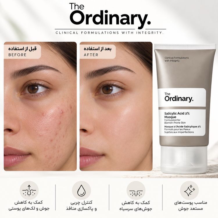 ماسک ضدلک، شفاف کننده، لایه بردار سالیسیلیک اسید 2% اوردینری THE ORDINARY Salicylic Acid 2% Masque مناسب برای پوستهای چرب و مستعد جوش حجم50 میلی لیتر